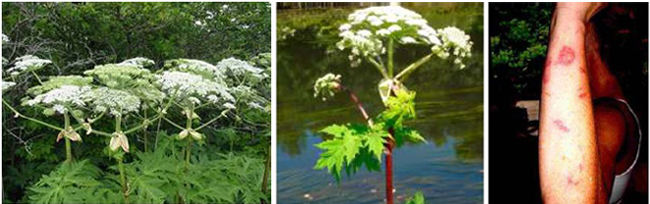 Giant Hogweed plant and photo of an arm with sores from noxious plant.